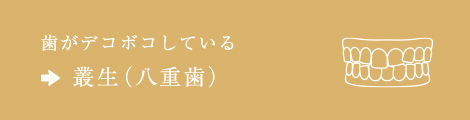 歯がデコボコしている⇒叢生（八重歯）