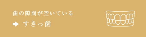 歯の隙間が空いている⇒すきっ歯