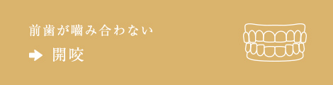 前歯が嚙み合わない⇒開咬