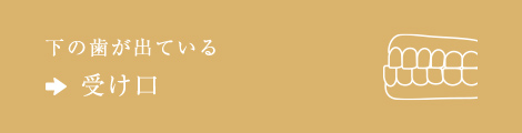 下の歯が出ている⇒受け口