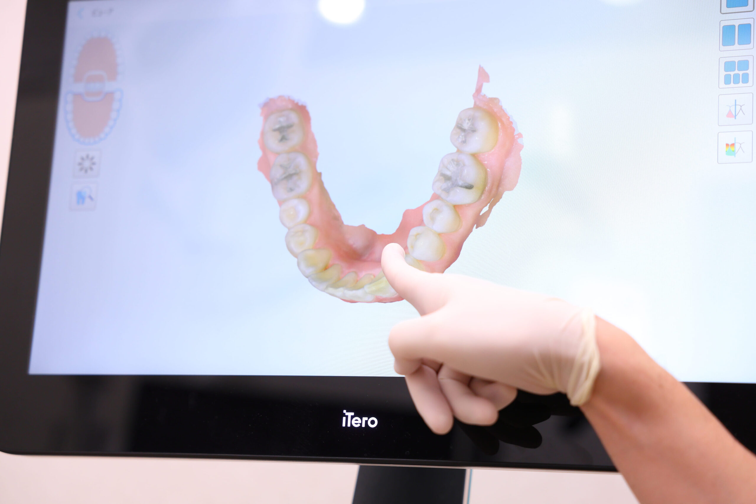 当院なら事前に治療シュミレーションを確認できます！