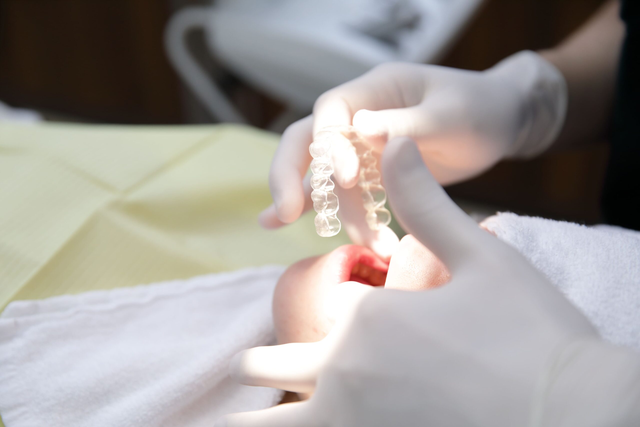 マウスピース矯正(インビザライン)