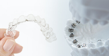 ハイブリッド矯正