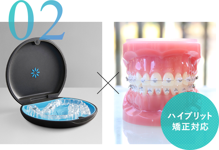 ワイヤー矯正×マウスピース矯正 豊富な矯正装置を取り揃えた患者様に合った治療計画のご提案 ハイブリット矯正対応