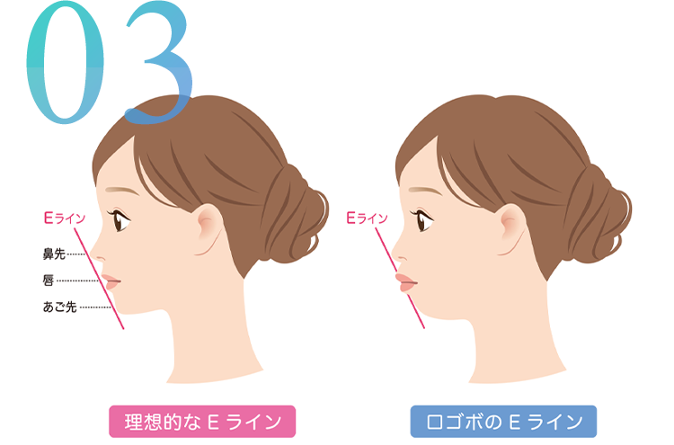 美しい横顔を目指したい方【E-ライン】フェイスラインから考える矯正歯科治療