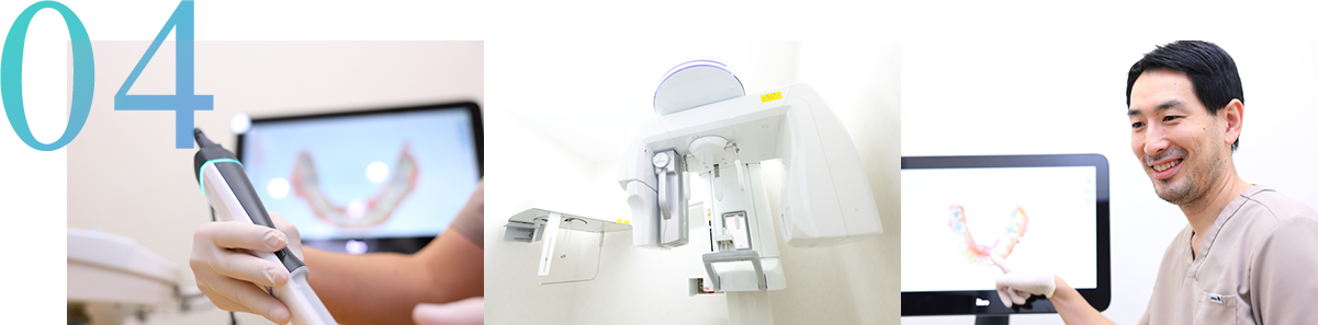 歯科用CT・セファロレントゲン 正確な診断を実現するデジタル設備「目で見て分かる」から安心